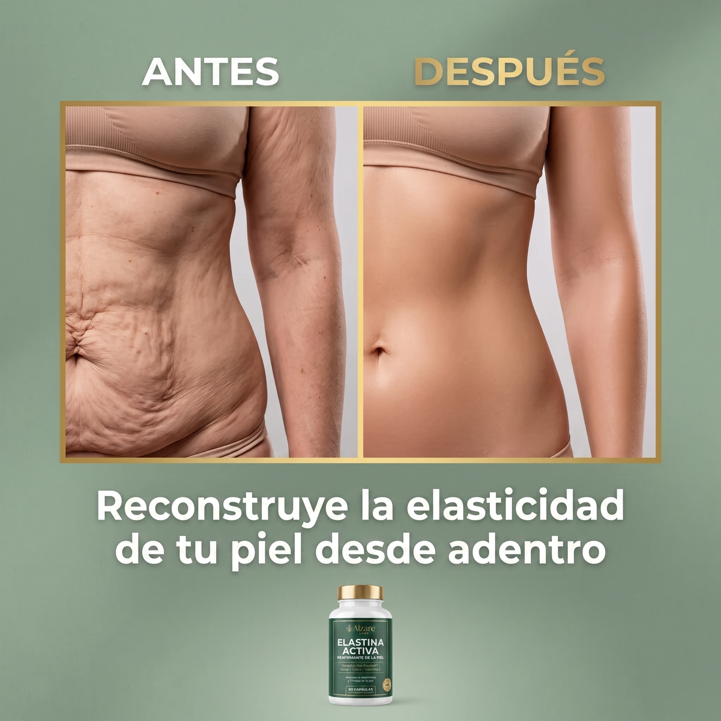 ALZARÉ® ELASTINA ACTIVA