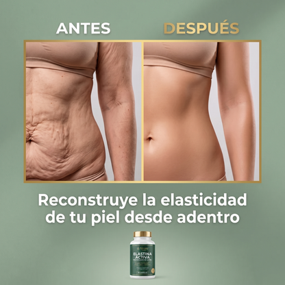 ALZARÉ® ELASTINA ACTIVA